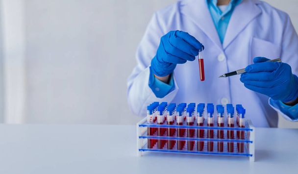 Медицинский исследователь и голубые латексные перчатки, предотвращающие появление микробов, показывают, что кровеносные сосуды пациента принимаются для проведения экспериментов в лаборатории. - Фото, изображение