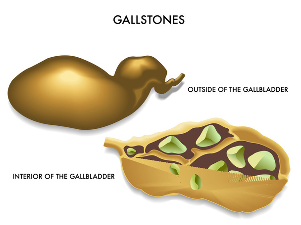 Cross section of gallbladder - Vector, Image