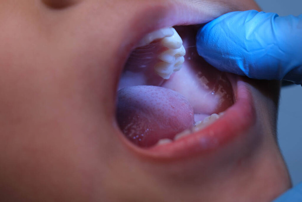 Güzel bebek dişleri olan sağlıklı bir çocuğun ağız boşluğuna yakın çekim. Genç kız ağzını açar üst ve alt dişleri, sert damak tadı, yumuşak damak, diş ve ağız sağlığı kontrollerini gösterir.. - Fotoğraf, Görsel
