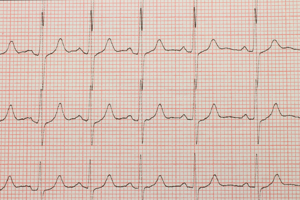 Primer plano del cardiograma
 - Foto, imagen