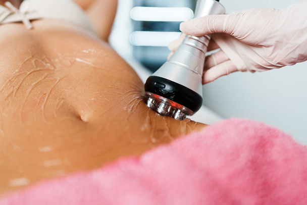 Cavitation RF body treatment and contemporary medicine for health beauty improvement and fat and cellulite removal - Foto, afbeelding