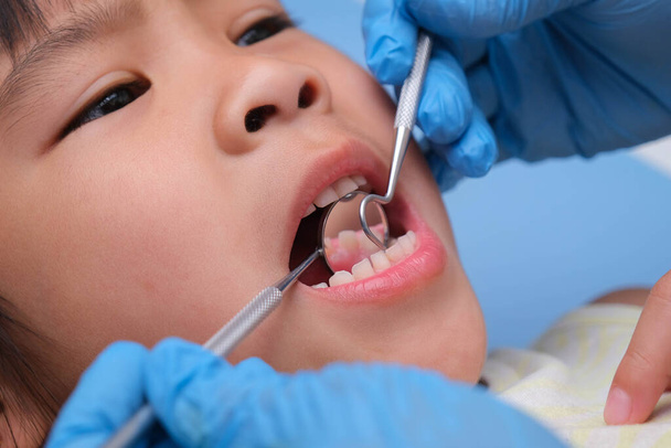 Güzel beyaz dişleri olan sağlıklı bir çocuğun ağız boşluğuna yakın çekim. Genç kız sağlıklı dişleri, sert ve yumuşak damak tadını ortaya çıkarmak için ağzını açar. Diş ve ağız sağlığı kontrolü - Fotoğraf, Görsel