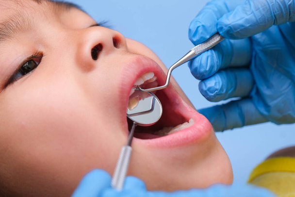 美しい白い歯を持つ健康な子供の口腔内のクローズアップ。若い女の子は健康的な歯を明らかにするために彼女の口を開きます,ハードと柔らかい味.歯科・口腔健康診断 - 写真・画像