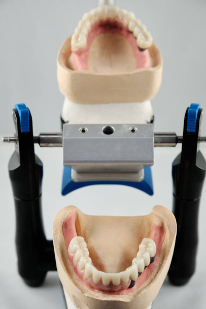 Dental photo of the articulator and two dental prostheses in the occlusion for accuracy and measurements. The concept of prosthetics and implantology. - Фото, изображение