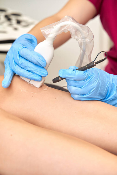 Close-up of percutaneous electrolysis treatment with an ultrasound machine on the leg. Health and medicine concept - Photo, Image
