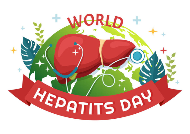 Maailman hepatiitti Päivän vektori Kuva potilaan sairaasta maksasta, syövästä ja kirroosista terveydenhuollossa Tasainen sarjakuva käsin piirretty lasku Sivu mallit - Vektori, kuva
