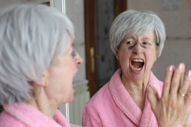 portret dojrzałej kobiety z siniakami po operacji plastycznej nosa przed lustrem w łazience - Zdjęcie, obraz