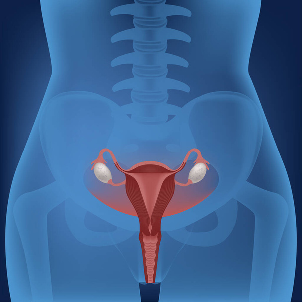 Neon Hintergrund. Torso einer Frau im Licht. Anatomische Struktur der Gebärmutter. Fortpflanzungssystem. Medizinisches Plakat. Vektorillustration - Vektor, Bild