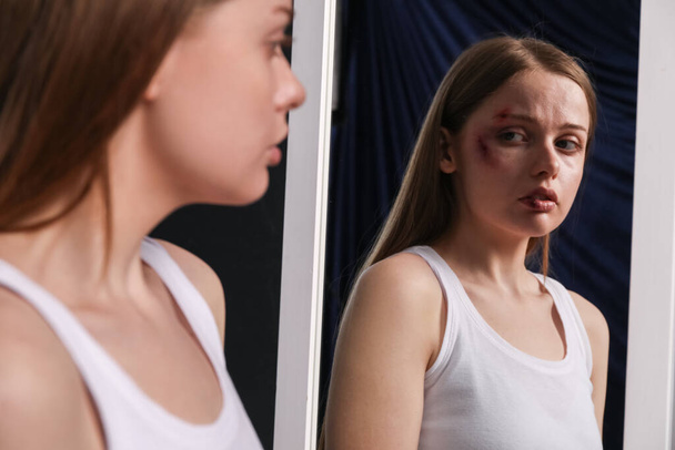 Mujer joven magullada cerca del espejo sobre fondo oscuro, primer plano. Concepto de violencia doméstica - Foto, imagen