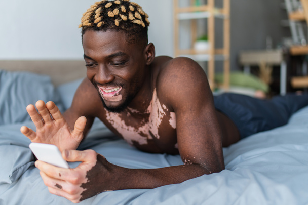 Alegre afroamericano hombre con vitiligo tener videollamada en el teléfono inteligente en la cama  - Foto, Imagen