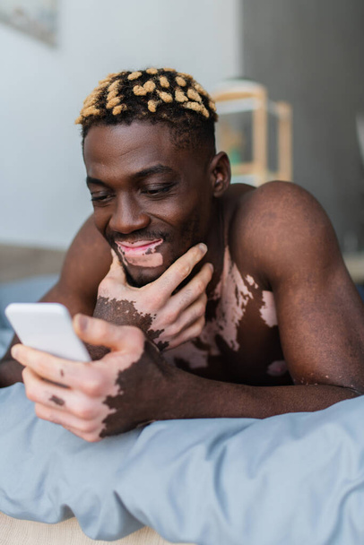 Carefree african american man with vitiligo using cellphone while lying on bed  - Valokuva, kuva