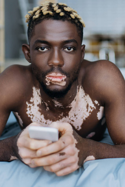 Portrait of african american man with vitiligo holding smartphone and looking at camera while lying on bed at home  - Foto, Bild