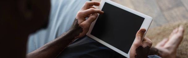 Vista recortada del hombre afroamericano con vitiligo sosteniendo tableta digital con pantalla en blanco en casa, bandera  - Foto, imagen
