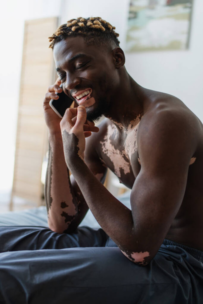Hombre afroamericano positivo y sin camisa con vitiligo hablando en el teléfono inteligente en la cama  - Foto, Imagen