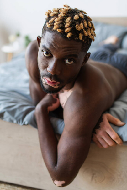 Portrait of shirtless african american man with vitiligo lying on bed in morning  - Фото, зображення