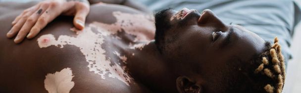 Shirtless african american man with vitiligo resting on bed at home, banner  - Foto, afbeelding