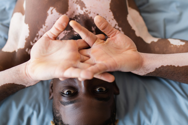 Vitiligo kaplamalı üstsüz Afro-Amerikan adam manzarası  - Fotoğraf, Görsel