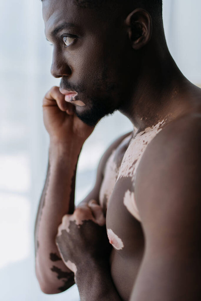 Side view of shirtless african american man with vitiligo standing at home  - Фото, изображение