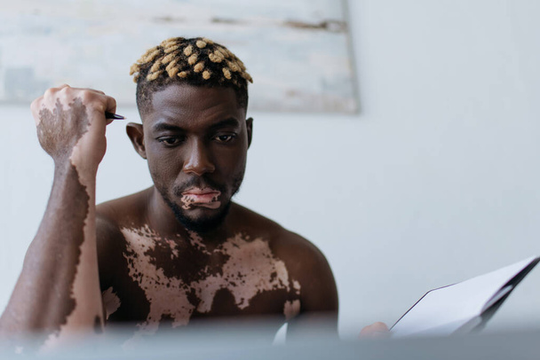 Hemdloser afrikanisch-amerikanischer Mann mit Vitiligo, der Stift und Notizbuch in der Nähe eines verschwommenen Laptops zu Hause hält  - Foto, Bild