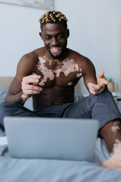 Cheerful african american man with vitiligo having video call on laptop in bedroom  - Fotó, kép