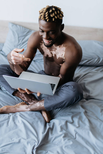 Hymyilevä ja paidaton afrikkalainen amerikkalainen mies vitiligo ottaa videopuhelu laptop sängyssä  - Valokuva, kuva