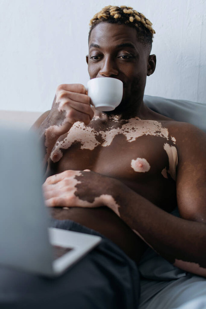 Shirtless african american man with vitiligo holding coffee and using laptop in bedroom  - Photo, Image