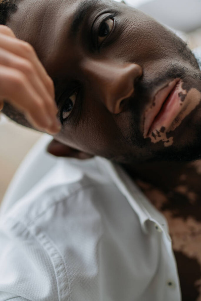 Portrait of african american man with vitiligo in white shirt sitting in blurred bathtub at home  - Valokuva, kuva