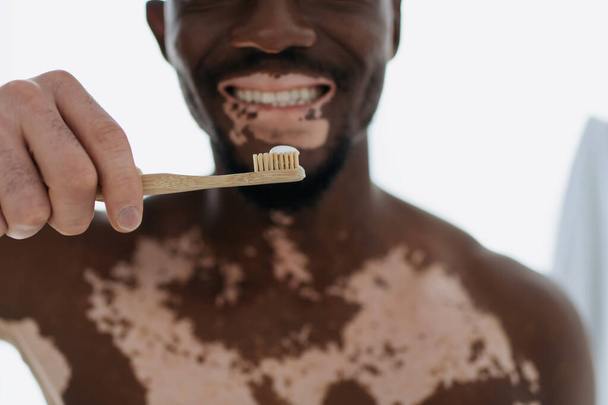 Vágott kilátás mosolygós afro-amerikai férfi vitiligo gazdaság fogkefe fogkrém  - Fotó, kép