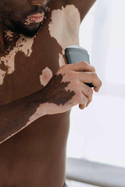 Gewassen weergave van shirtloze Afrikaanse Amerikaanse man met vitiligo met behulp van deodorant thuis  - Foto, afbeelding