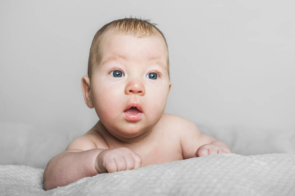 Noworodek 2 miesiące z atopowym zapaleniem skóry z bliska portret. Pielęgnacja dzieci, kolka, ząbkowanie, płacz - Zdjęcie, obraz