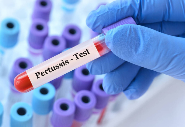 Doctor holding a test blood sample tube with Pertussis test on the background of medical test tubes with analyzes. - Φωτογραφία, εικόνα