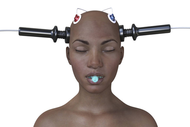 Terapia electroconvulsiva, ECT, un tratamiento utilizado para enfermedades mentales graves que implican el uso de corrientes eléctricas para estimular el cerebro, ilustración 3D - Foto, imagen