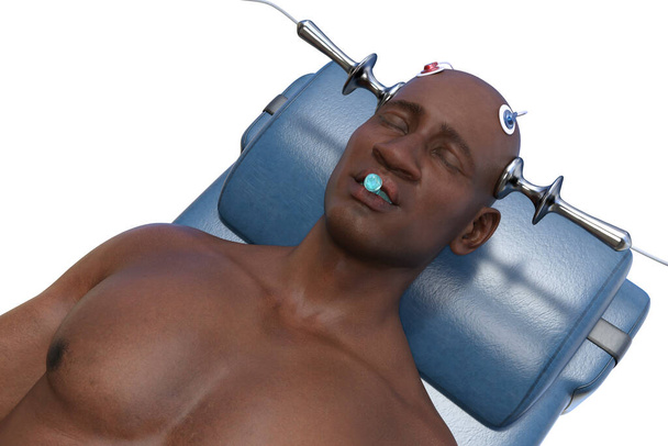 Електроконвеєрна терапія (ЕКТ) - лікування, що застосовується для тяжких психічних захворювань, пов "язаних з використанням електричних струмів для стимулювання мозку, 3D-ілюстрація. - Фото, зображення
