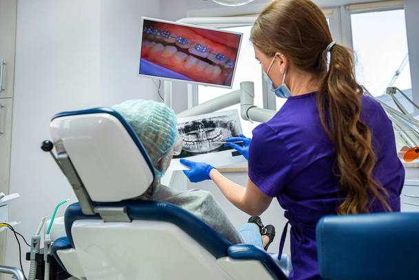 στην επαγγελματική οδοντιατρική, ένας οδοντίατρος που ξέρει τη δουλειά του βγάζει φωτογραφίες για έναν ασθενή με άρρωστα δόντια. Η έννοια των εικόνων των δοντιών στους ασθενείς - Φωτογραφία, εικόνα