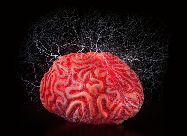 Καουτσούκ ανθρώπινο εγκέφαλο με ηλεκτροσόκ - Φωτογραφία, εικόνα