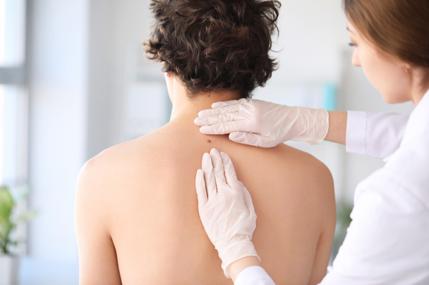Dermatologist examining mole on young man's back in clinic, closeup - Photo, Image