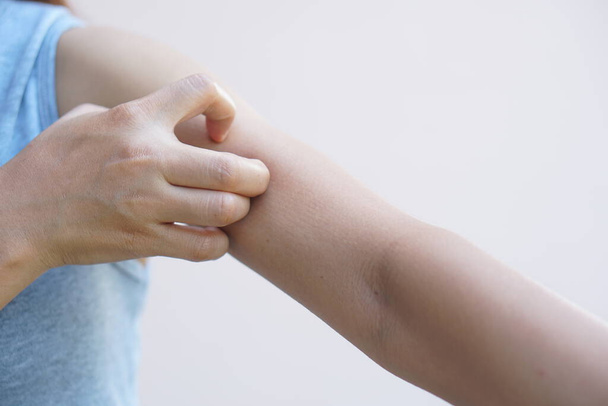 Asian woman having itchy skin on arm - Foto, Bild
