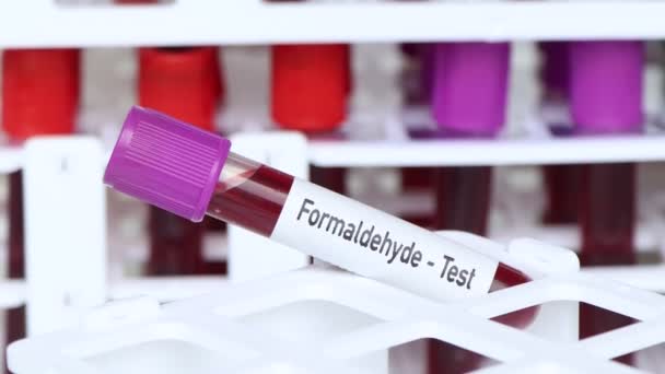 Teste de formaldeído, amostra de sangue para analisar no laboratório, sangue no tubo de teste - Filmagem, Vídeo
