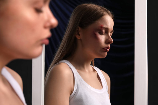 Μελανιασμένη νεαρή γυναίκα κοντά στον καθρέφτη σε σκούρο φόντο, κοντινό πλάνο. Έννοια της ενδοοικογενειακής βίας - Φωτογραφία, εικόνα