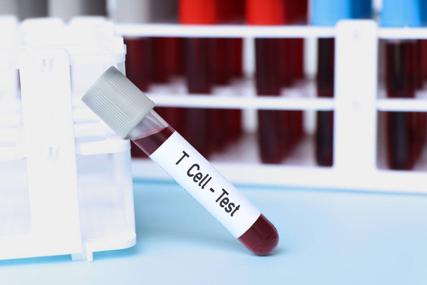T Komórki - Test, próbka krwi do analizy w laboratorium, krew w probówce - Zdjęcie, obraz