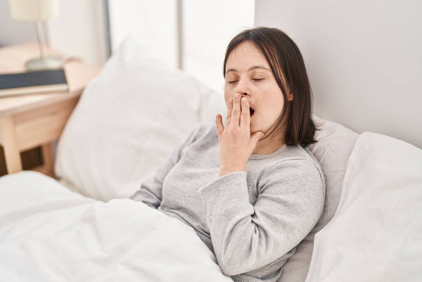 Mujer joven con síndrome de Down Despertando bostezando en el dormitorio - Foto, imagen