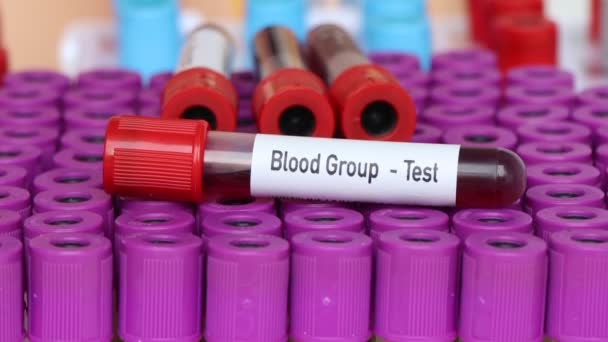 Тест групи крові, аналіз крові в лабораторії, аналіз крові в пробірці
 - Кадри, відео