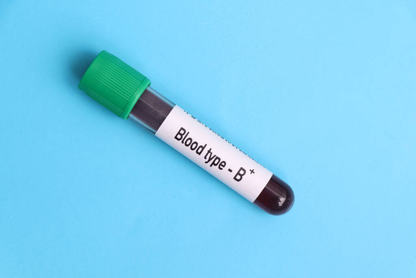 Blood type B Rh positive test, blood sample to analyze in the laboratory, blood in test tube - 写真・画像