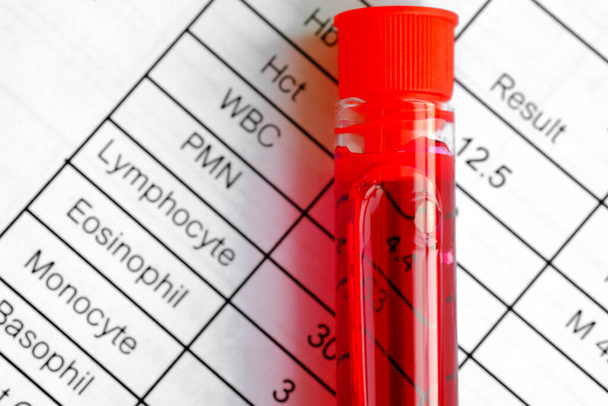 Vollständige Blutproben und Ergebnisse von Bluttests. Gesundheits- und medizinische Konzepte - Foto, Bild