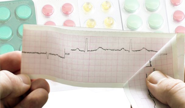 EKG käsissä lääkäreiden taustalla eri
  - Valokuva, kuva