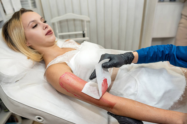doctora cosmetología poniendo crema gel de cera caliente en la mano, cliente femenino recibe procedimiento de azúcar en la clínica. Epilación con pasta de azúcar líquida - Foto, Imagen