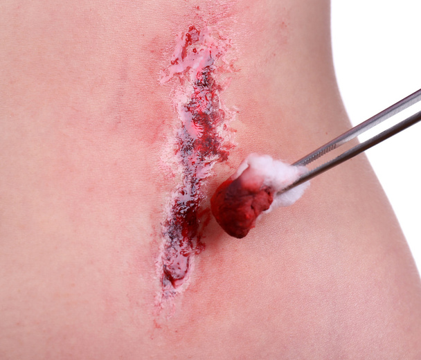 Injured abdomen with blood isolated on white - Φωτογραφία, εικόνα