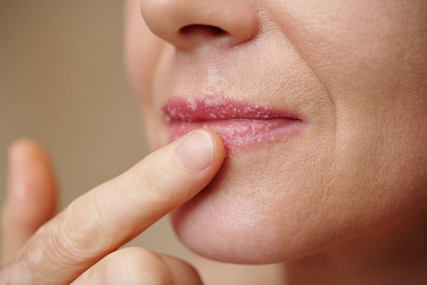 Imagen de cerca de la mujer fregando los labios para deshacerse de las células muertas de la piel - Foto, Imagen