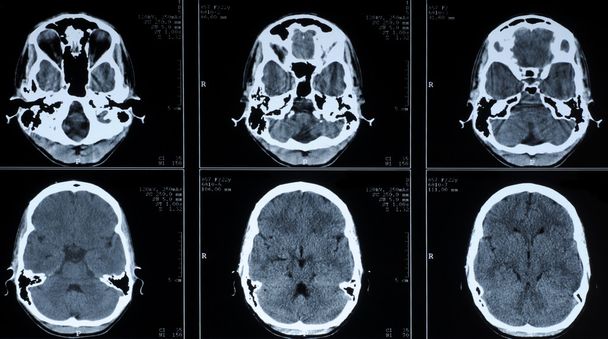 CT photographie du cerveau humain
 - Photo, image
