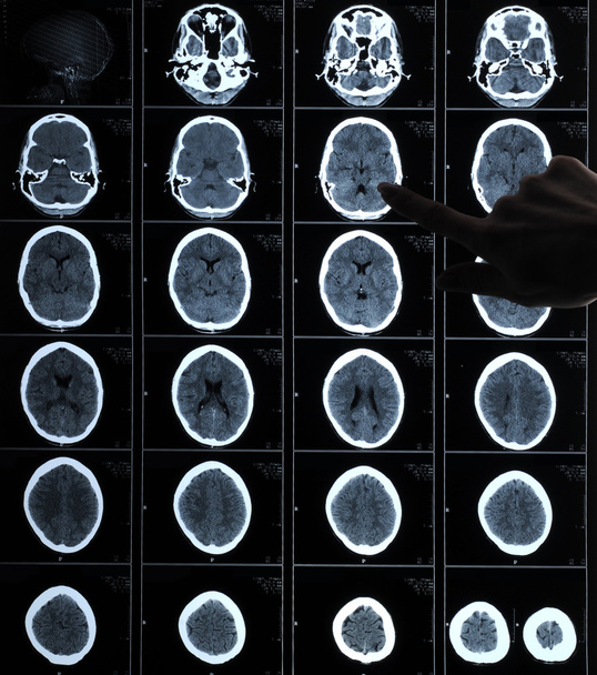 CT fotografie lidského mozku - Fotografie, Obrázek